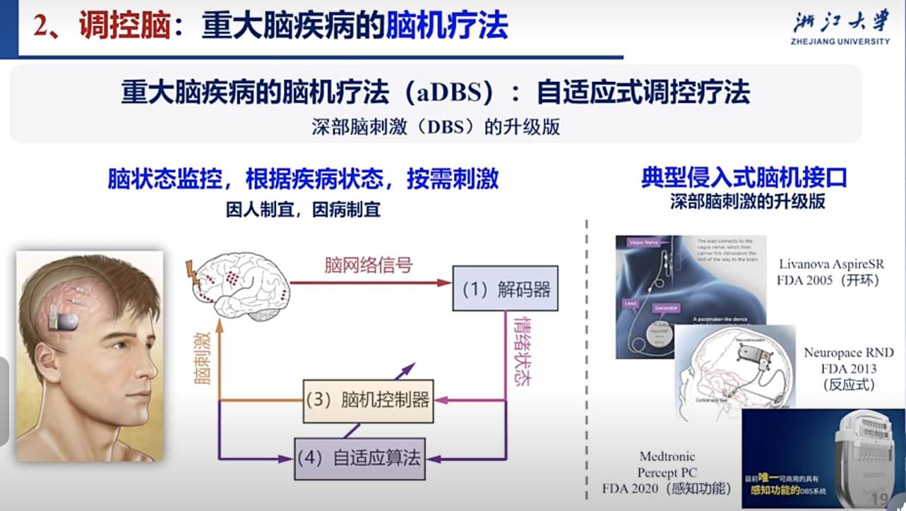 ����ʽ�Ի��ӿ�ʵ�֡��Կء��롰���ԡ�ͻ�ƣ�����ɵ��缫�����ɹؼ�